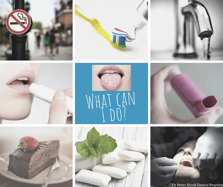 Medicine-Induced Dry Mouth